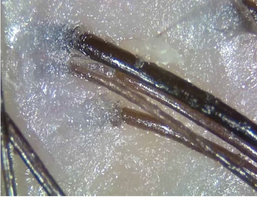 Portable Wireless Digital Skin Analyzer