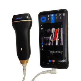 Diagnostic Handheld Ultrasound Scanner Equipment Wireless With 8 TGC Adjustments