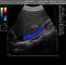 Portable Color Doppler Ultrasound Machine With Measurements And Calculations Software