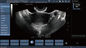 Transvaginal Probe Mobile Color Doppler Ultrasound Scanner For Pregnancy