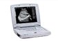 Ultrasound Scan Machine Portable Ultrasound Scanner with 10.4 Inch LED Monitor