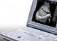Portable Ultrasound Machine for Pregnancy Portable Ultrasound Scanner Only 2.2kgs Weight