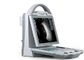 White Mobile Ultrasound Scanner B/W Portable Laptop Ultrasound Machine