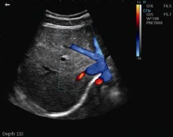 Digital Color Doppler Portable Ultrasound Equipment With PW CFM THI Mode