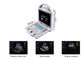 B Ultrasound Scanner Portable Doppler Ultrasound Machine with Only 4.5Kgs Weight