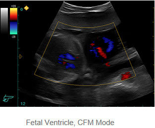 Ultrasound Scan Equipment Portable Ultrasound Scanner with Probe Frequency 2. 0MHz～10. 0MHz