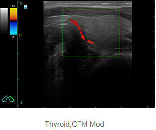 Ultrasound Scan Equipment Portable Ultrasound Scanner with Probe Frequency 2. 0MHz～10. 0MHz