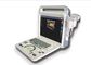 4d Ultrasound Equipment Portable Ultrasound Scanner With Phased Array Probe of Center Frequency 3MHz