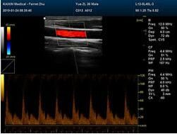 B Ultrasound Scanner Portable Ultrasound Scanner with Built-in 4D Module with Optional 4D Volume Probe