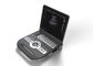 4d Ultrasound Machine Portable Ultrasound Scanner With 120G Capacity 4800 Frames​ Cine Loop
