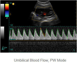 Color Doppler Ultrasound System Portable Ultrasound Scanner With 12.1 Inch LED Monitor And 2 Probe Ports