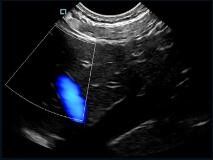 Mini Pocket Handheld Ultrasound Scanner