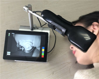 Safe Portable Infrared Vein Locator Device Vein Scanner Screen Displayed