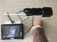 Medical Portable Vein Locator Device Spider Vein Removal Machine Imaging Depth &lt; 10mm