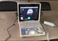 12 Inch LED Screen Portable Digital Ultrasound Scanner with All Kinds of Probes