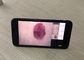 Medical Device Video Dermatoscope Skin and Scalp Analysis Machine Image resolution 1280*720