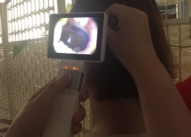 SD Card Digital Video Otoscope For Human Body Inspection With 3.5” LCD Monitor