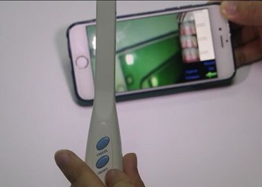 Connected Mobilephone By APP Digital Video Otoscope