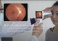 Eye Diagnosis Digital Fundus Camera Equipment To Fundus Diseases