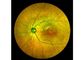 Retina Angiograph Digital 160° Ophthalmic Equipment