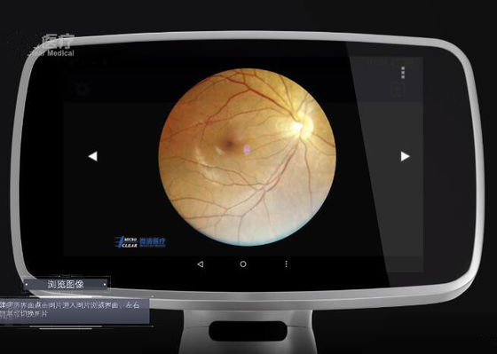 Wifi APP Digital Fundus Camera With Internal Capacity 16GB