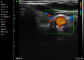 Ipad Handheld Ultrasound Scanner Portable Color Doppler Abdominal Vascular Pediatrics Gynecology Application