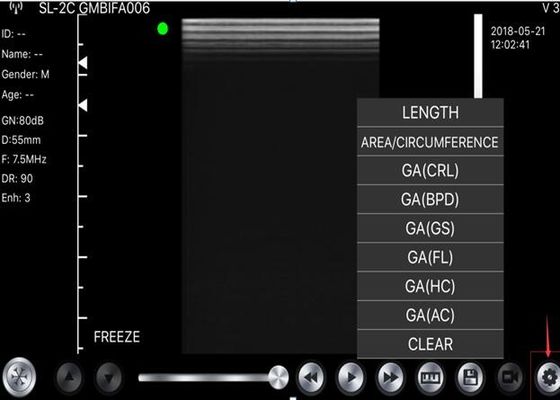 5G Handheld Ultrasound Scanner
