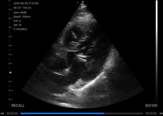 5G Handheld Ultrasound Scanner