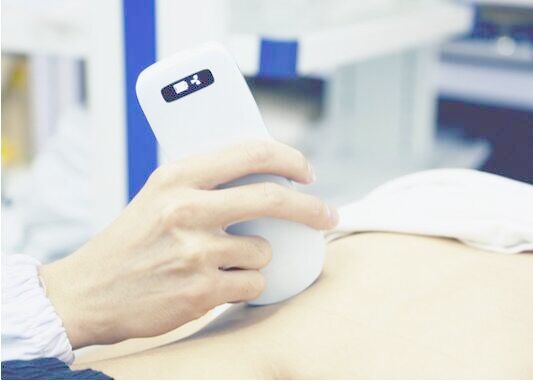 IOS Android Windows Handheld Portable Ultrasound Device Convex Linear Cardiac 3 IN 1 Ipad Ultrasound Probe