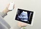 Ultrasound Color Doppler Diagnostic Ultrasound Equipment Download Software From App Store or Google Play 3 In 1 Wireless
