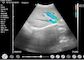 Home Doppler Ultrasound Portable Diagnostic Hand held Doppler Ultrasound Obstetric Gynecology Pediatrics Application