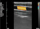 Color Ultrasound Machine Home Ultrasound Scanner Portable Ultrasound For Pregnancy 8 TGC 3.5~10 MHz