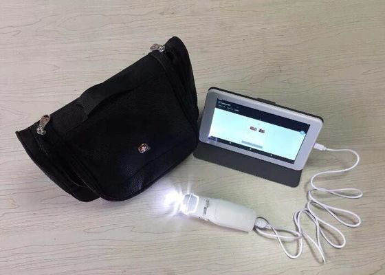 Digital Endoscope Self-Inspect Colposcope