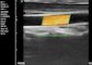 Pregnancy Wifi Color Doppler Ultrasound Scanner With Ob / Gyn Measurement