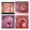 Vaginal Camera Digital Electronic Colposcope to Find Disease of Cervix Eealier
