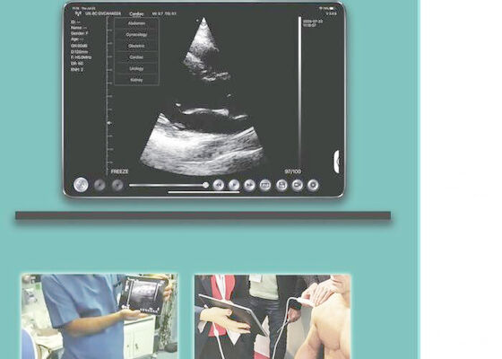 2.5mhz Dual Heads Convex Handheld Ultrasound Scanner