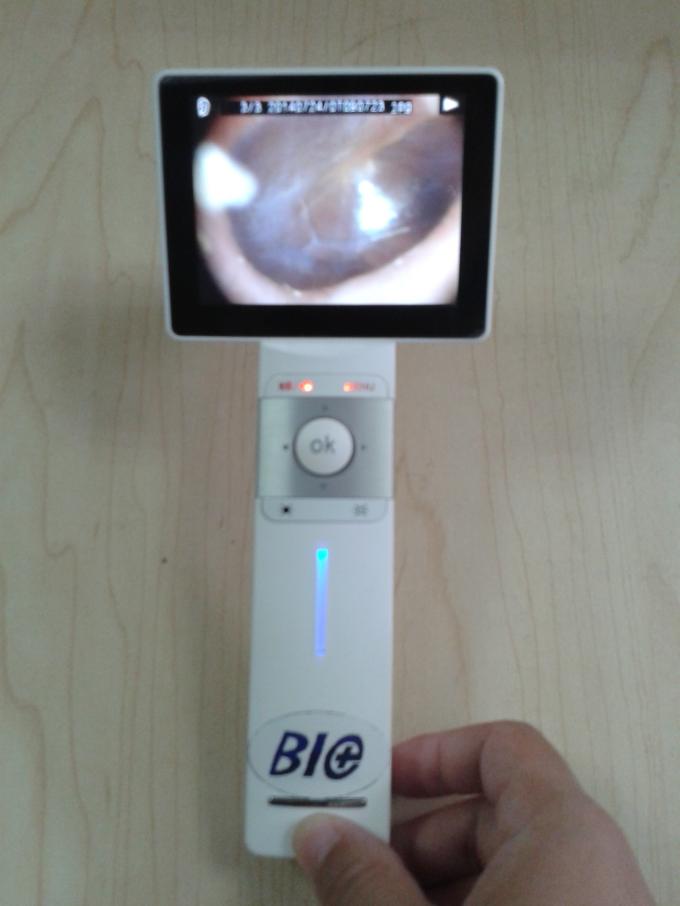 Professional Ear Skin Throat Camera Digital Video Otoscope With 1920 x