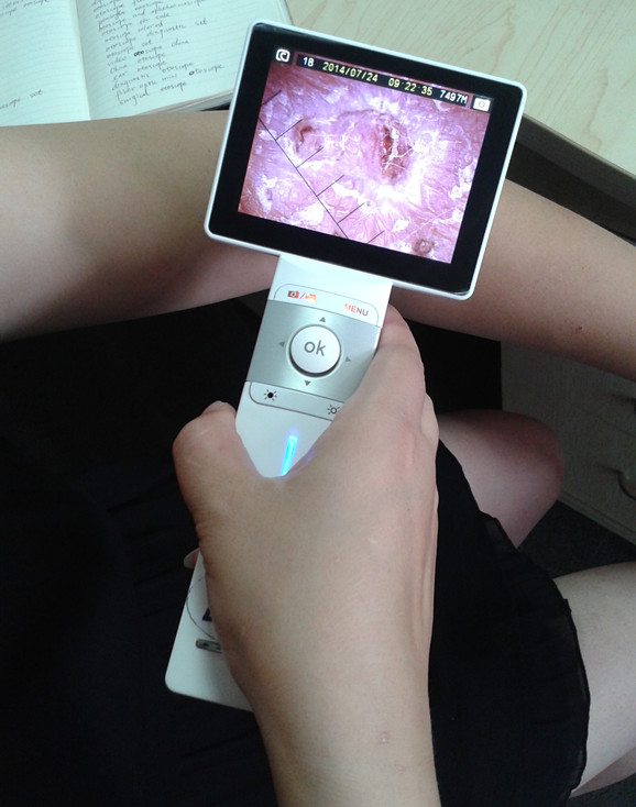 Professional Ear Skin Throat Camera Digital Video Otoscope With 1920 x