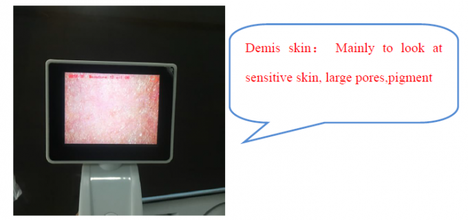 CE BS5SH Digital Skin Analyzer Digital Skin Moisture Meter For Doctor 2