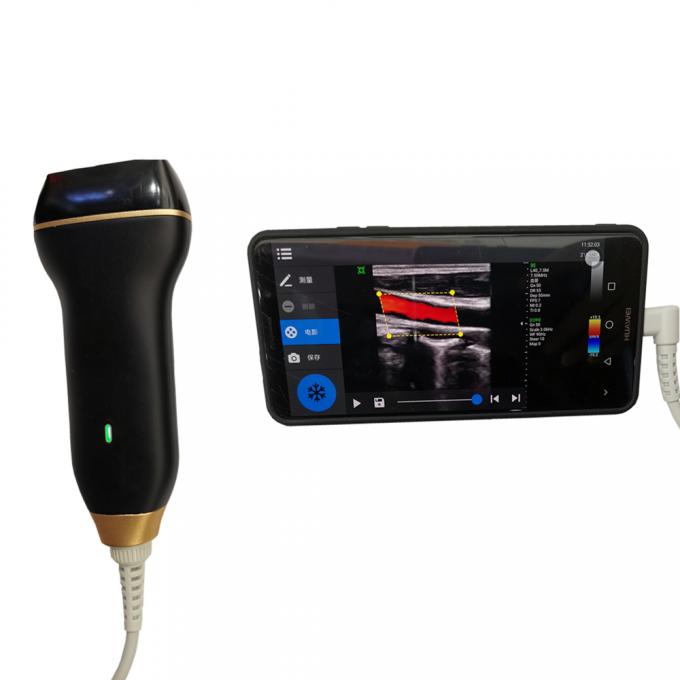 at home ultrasound machine for phone