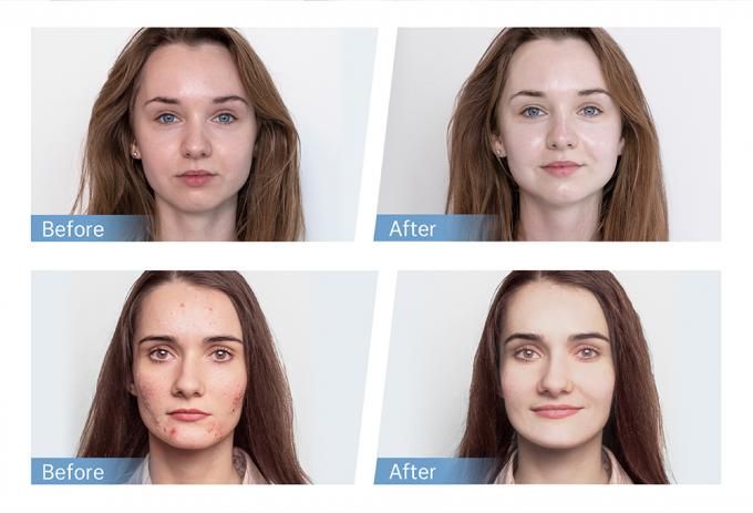 Factory Sale Hydra Pen H5 EMS Electrical Microneedling Pen for Collagen Regeneration Hair Beard Regrowth Home and Salon Use 4