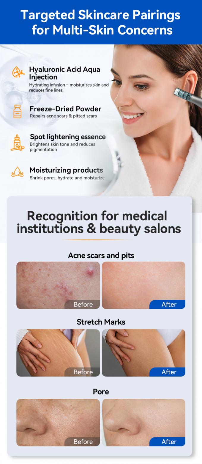 Original Brand Hydra Pen H5 MicroNeedling Derma Pen with EMS Adjustable Serum Output MTS Reduce Scars Fine Lines Wrinkles 6