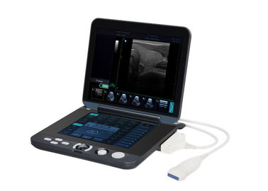 128 Images Permanent Storage Portable Digital Ultrasound Scanner with 12 Inch LED Screen