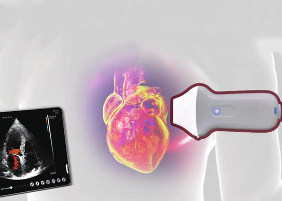 PDI WiFi Wireless Portable Ultrasound Scanner 128 Element